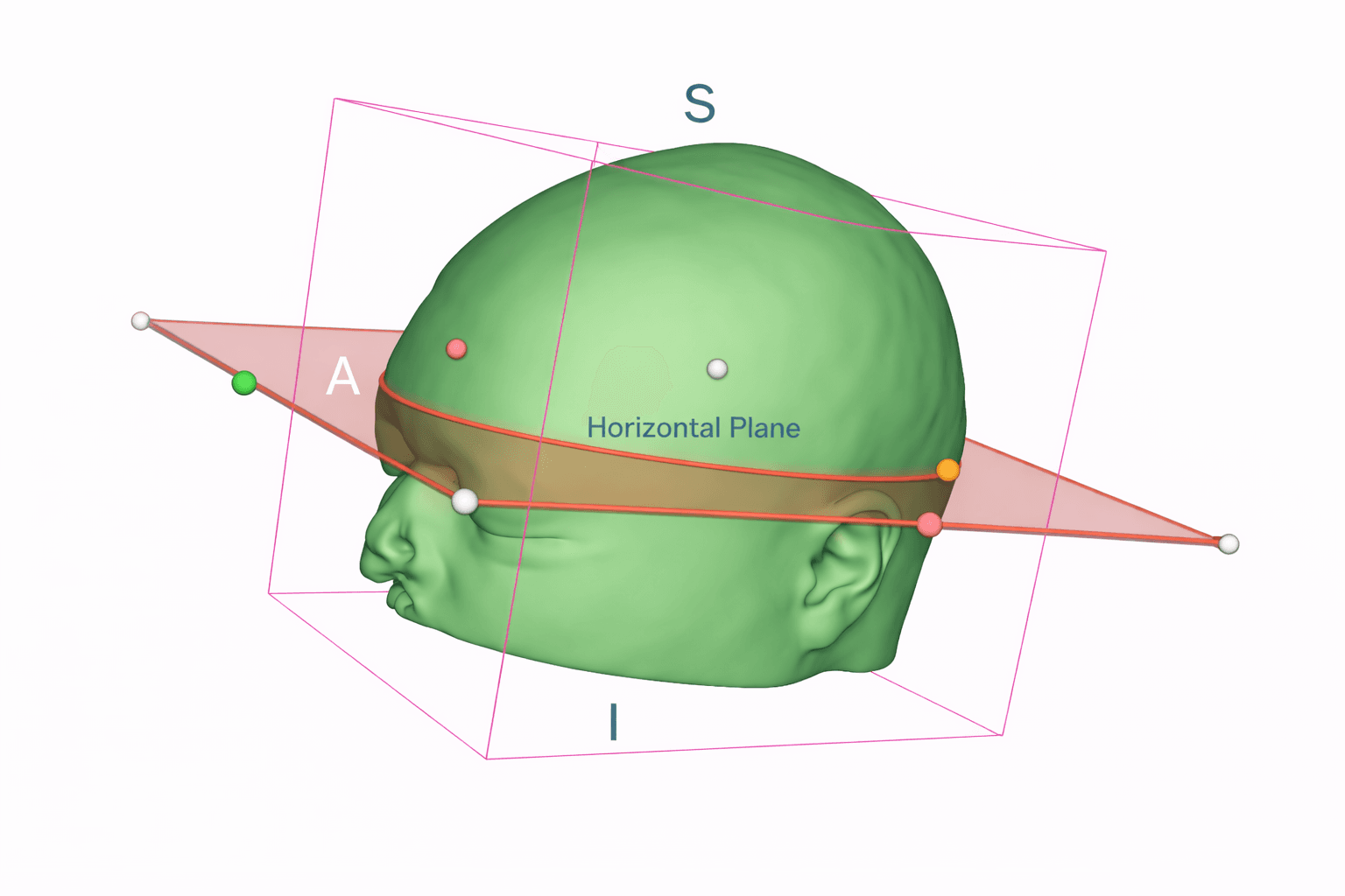Analyse morphologique automatisée à partir d'images médicales