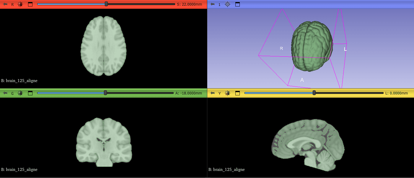 Analyse morphologique automatisée à partir d'images médicales
