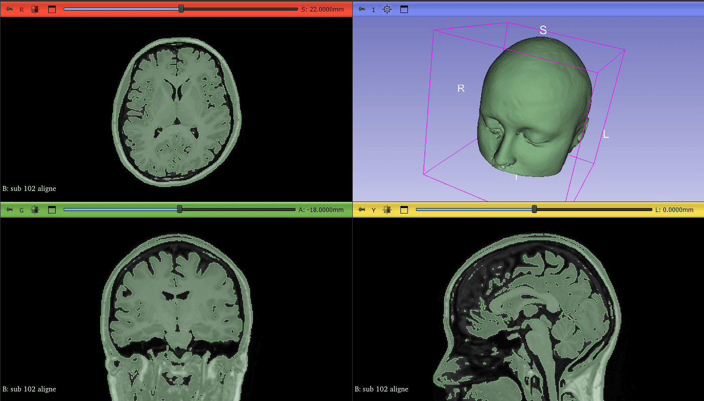 Analyse morphologique automatisée à partir d'images médicales